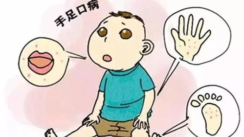 止咳化痰最快的方法，这些有效手段你必须知道